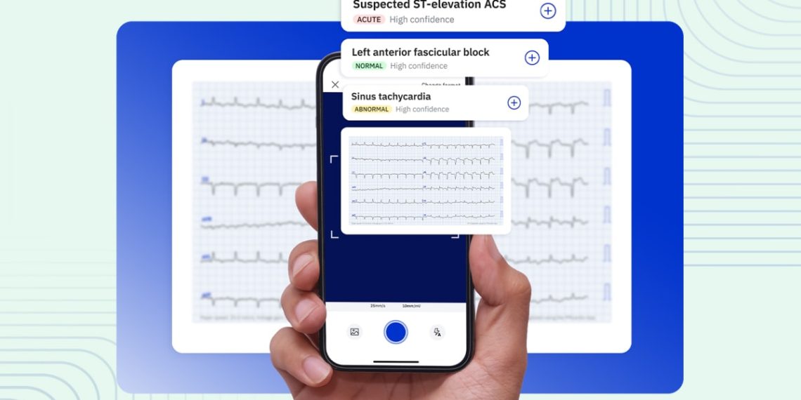 AI-Powered ECG: The Surprising Tool for Predicting Business Health