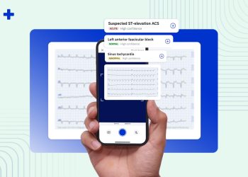 AI-Powered ECG: The Surprising Tool for Predicting Business Health